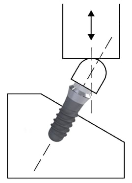 IL-34_Dental_Fatigue_Testing-DIN-ISO-14801_3