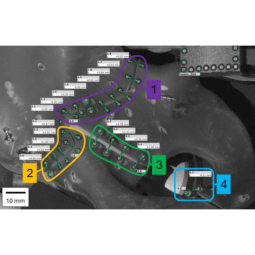 2026_Beckmann_Comparison of the Biomechanical Stability_1000x1000